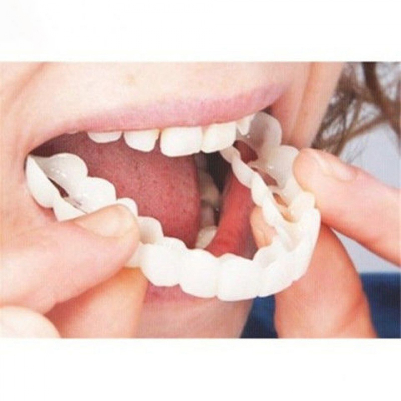 Teeth Whitening Veneers - Ajustement parfait couverture de fausses dents