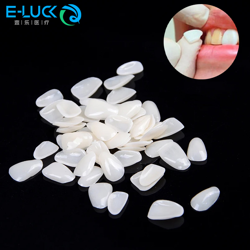 Teeth Whitening Veneers - Placage de dents dentaires, couronne temporaire,