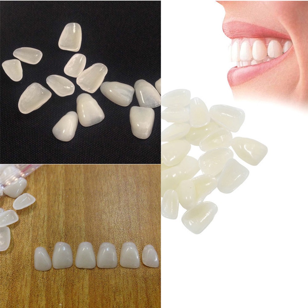 Teeth Whitening Veneers - 70 pièces/paquet, facettes dentaires esthétiques blanchissantes