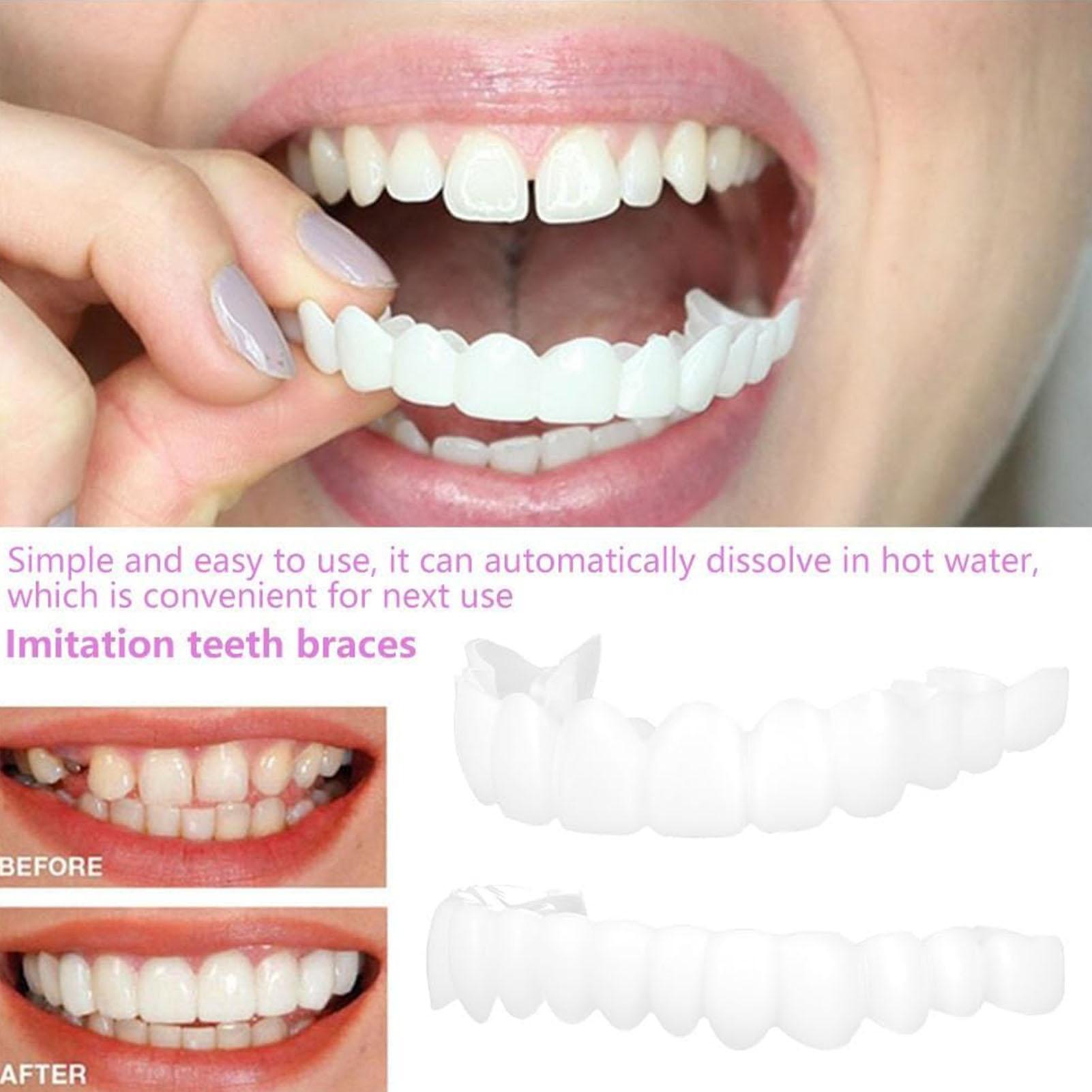Teeth Whitening Veneers - 2 pièces hommes femmes dents temporaires