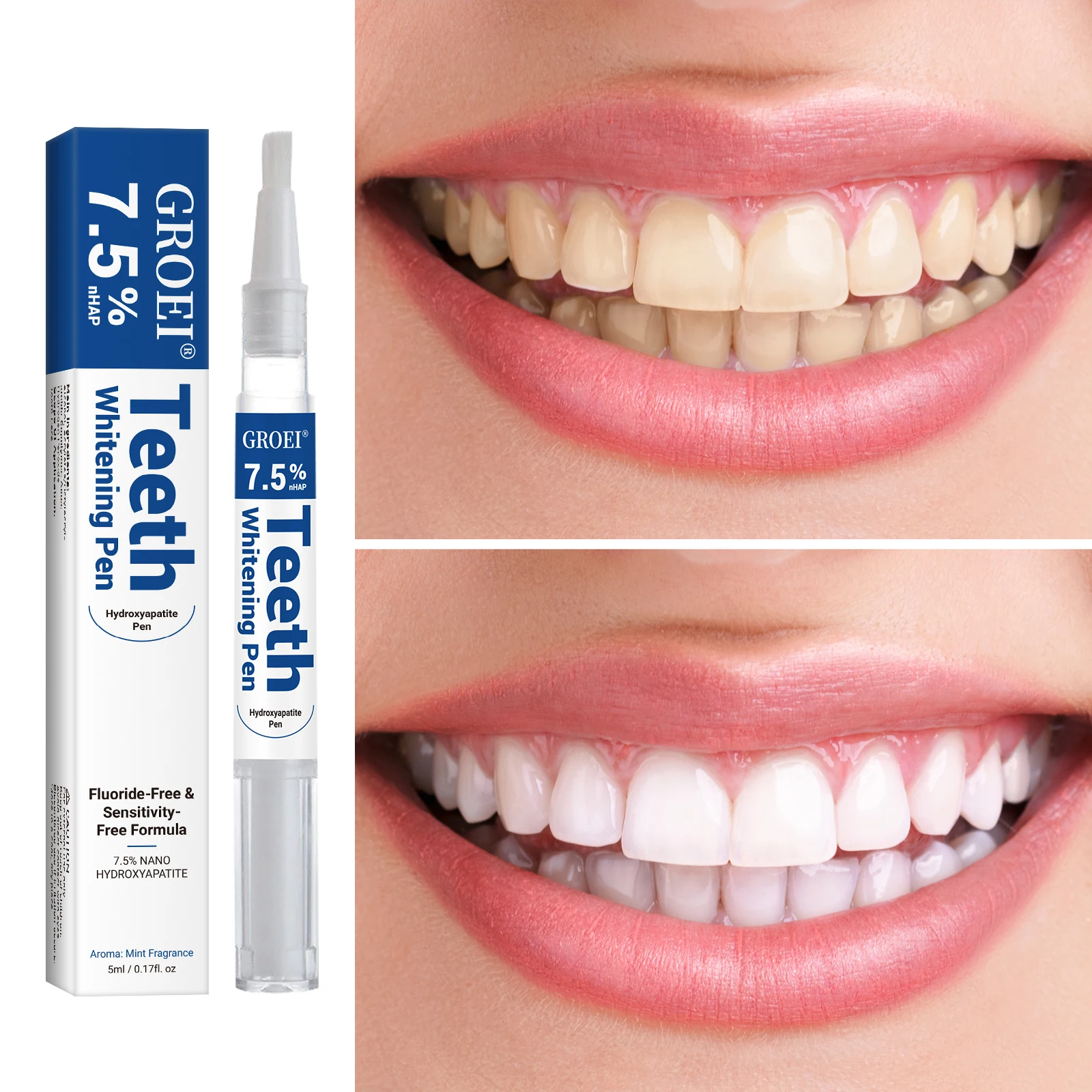 Stylo de blanchiment des dents - Teeth Whitening With Hydrogen Peroxide avis et prix