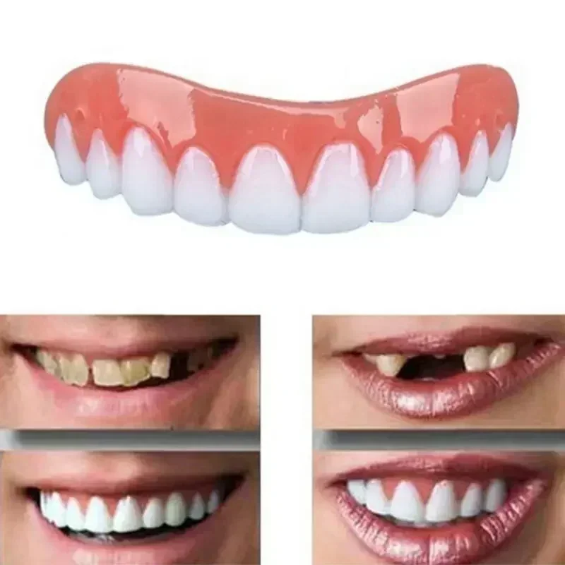 Nouvelles fausses dents en sil - Teeth Whitening Veneers avis et prix