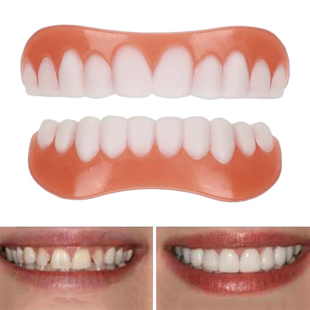 Nouvelles fausses dents en sil - Teeth Whitening Veneers avis et prix