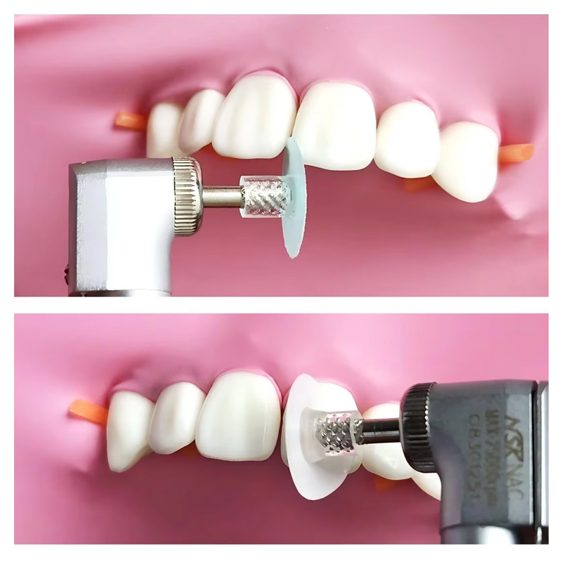 40 disques de polissage dentai - Whitening Teeth Dentist avis et prix