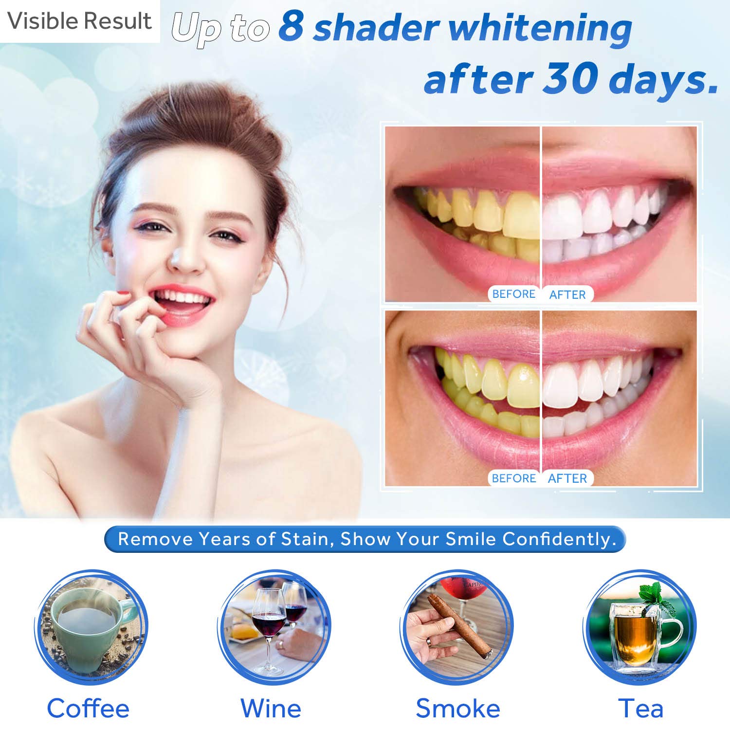 Gel de blanchiment des dents r - Teeth Whitening With Hydrogen Peroxide avis et prix