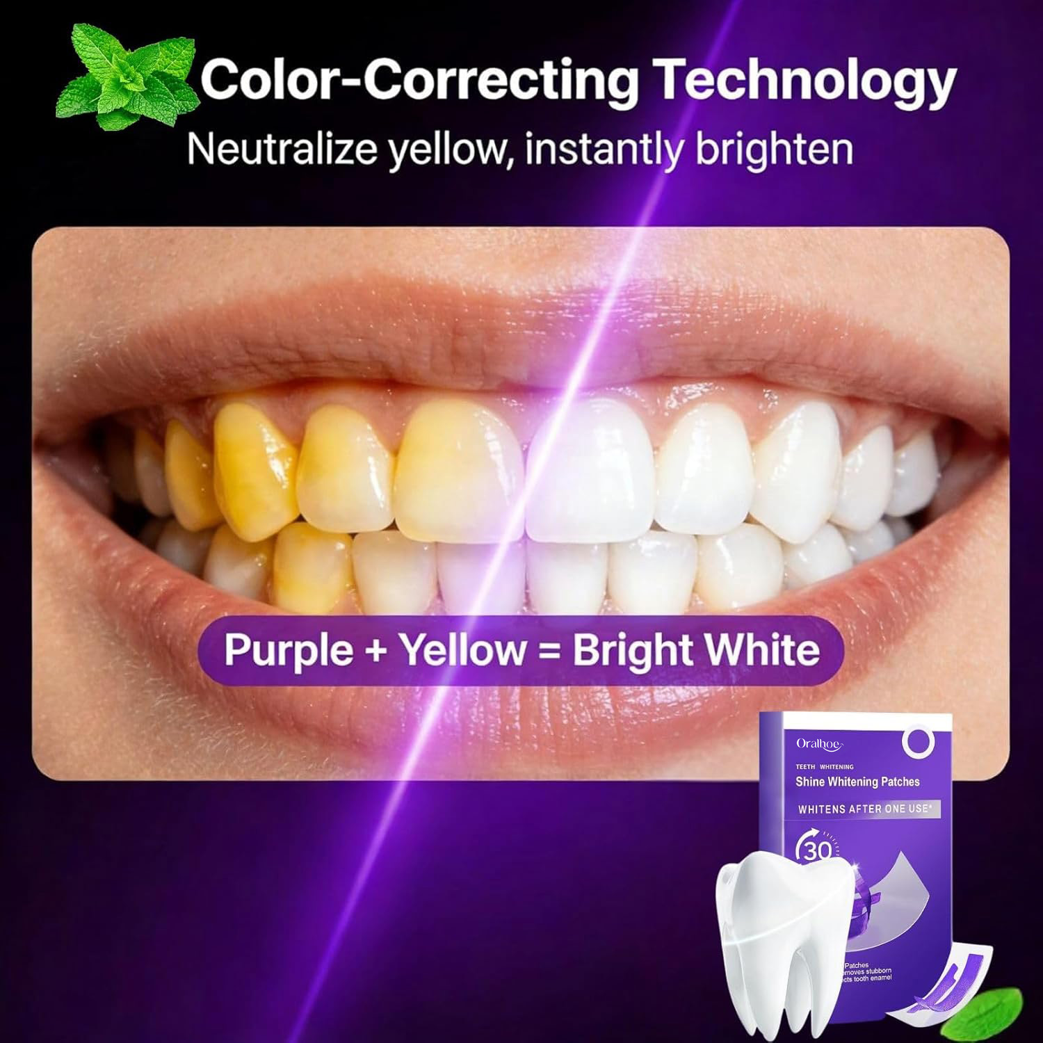 Kit Combiné de Blanchiment Den - Teeth Whitening Home Kit avis et prix