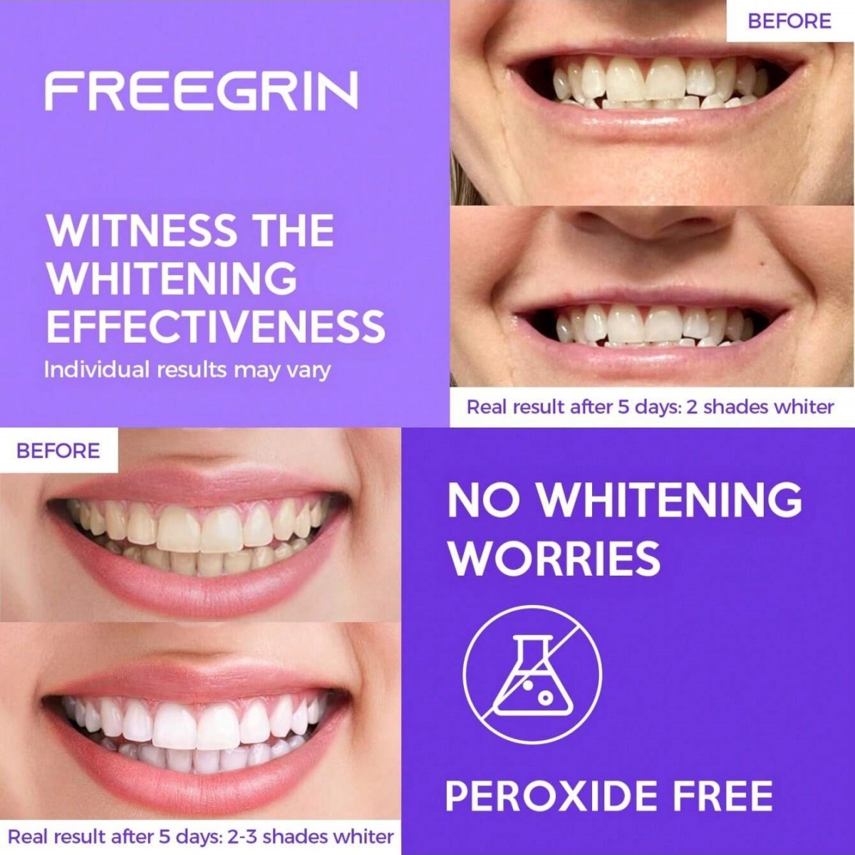 Autocollants de blanchiment de - Teeth Whitening With Hydrogen Peroxide avis et prix