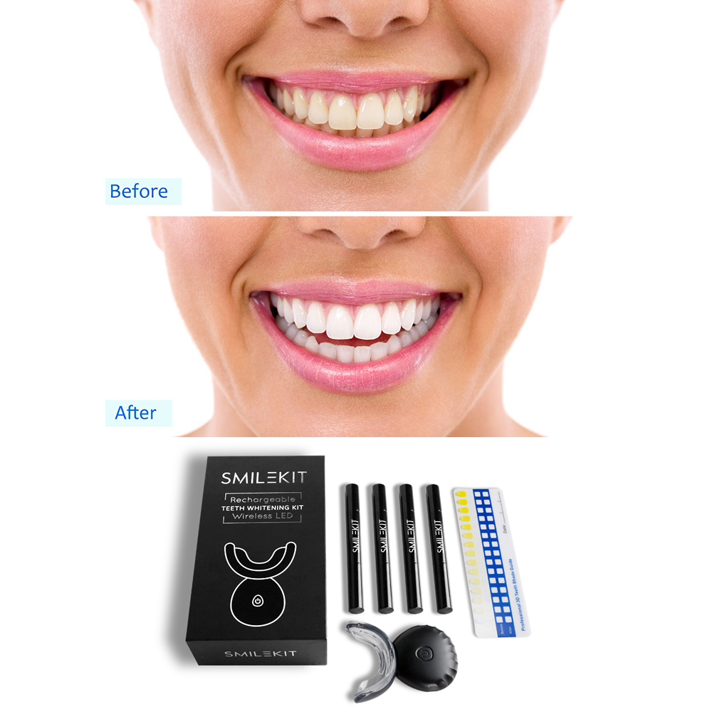 Kit de blanchiment des dents é - Teeth Whitening Home Kit avis et prix
