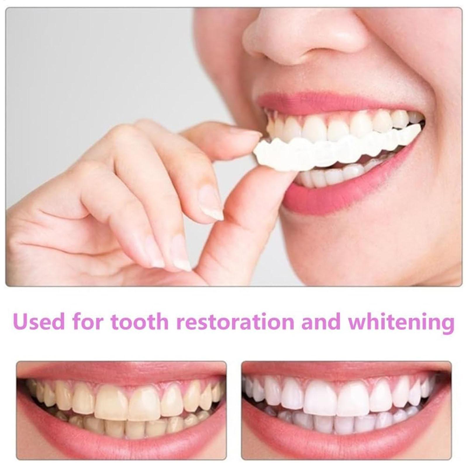 2 pièces hommes femmes dents t - Teeth Whitening Veneers avis et prix