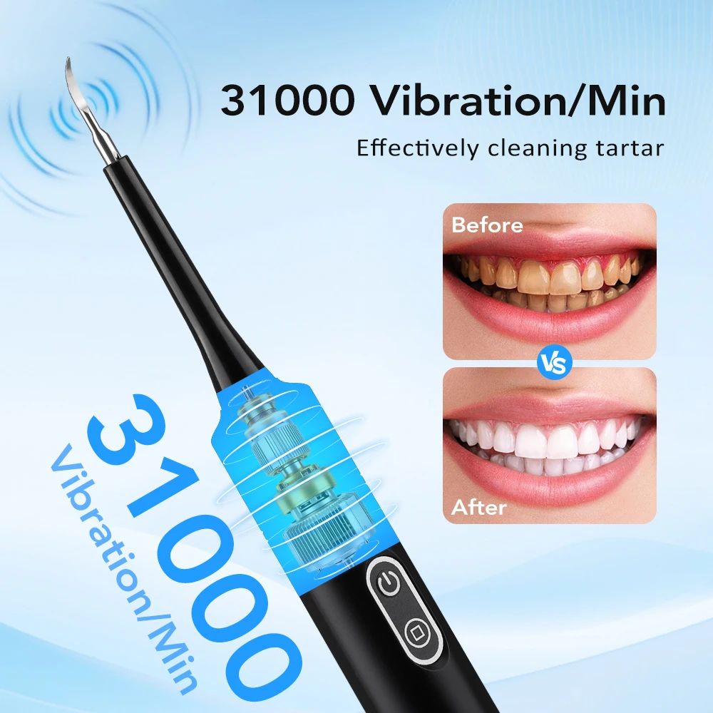 Détartreur dentaire électrique - Whitening Teeth Dentist avis et prix